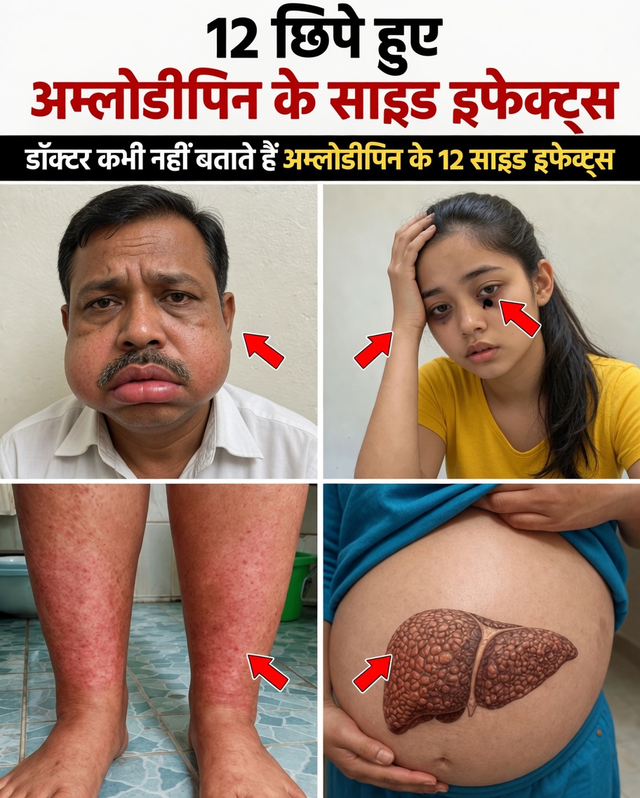 एम्लोडिपिन के 12 सामान्य दुष्प्रभाव जिनके बारे में आपको पता होना चाहिए: बेहतर जागरूकता और क्या अपेक्षा करें के लिए एक संपूर्ण मार्गदर्शिका