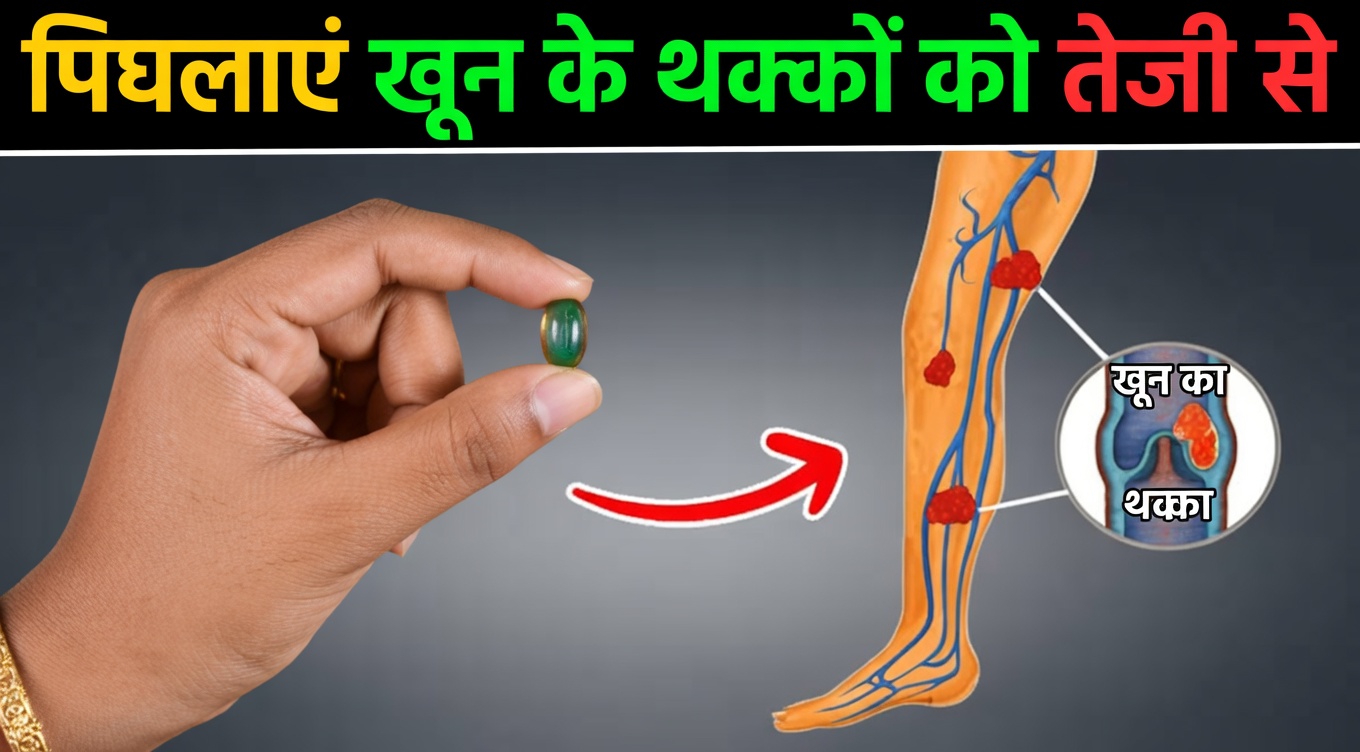 पैरों में खून के थक्के घोलने के लिए रोज़ 1 विटामिन: हृदय रोग विशेषज्ञ की सलाह