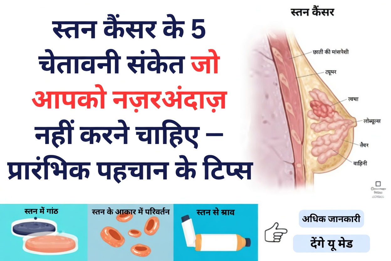 स्तन कैंसर के 10 शुरुआती संकेत और लक्षण जिन्हें आपको कभी नज़रअंदाज़ नहीं करना चाहिए
