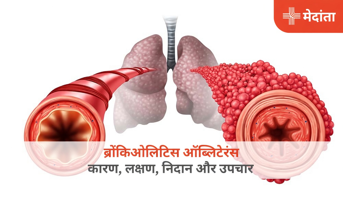 वेपिंग और पॉपकॉर्न लंग: एक छिपा खतरा जिसे कई वयस्क अब भी नज़रअंदाज़ करते हैं