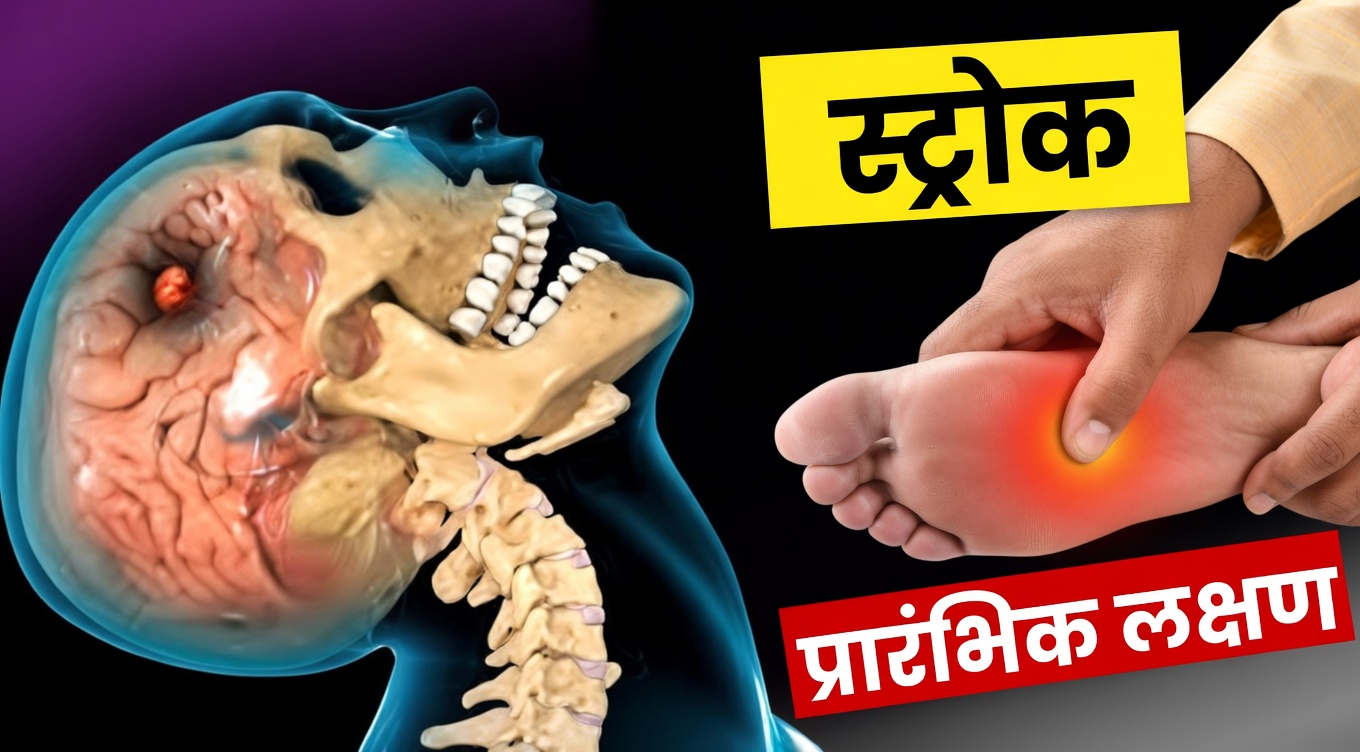 8 सूक्ष्म चेतावनी संकेत जो एक महीने पहले ही स्ट्रोक के जोखिम का संकेत दे सकते हैं + आपकी संभावना कम करने के लिए 9 व्यावहारिक सुझाव