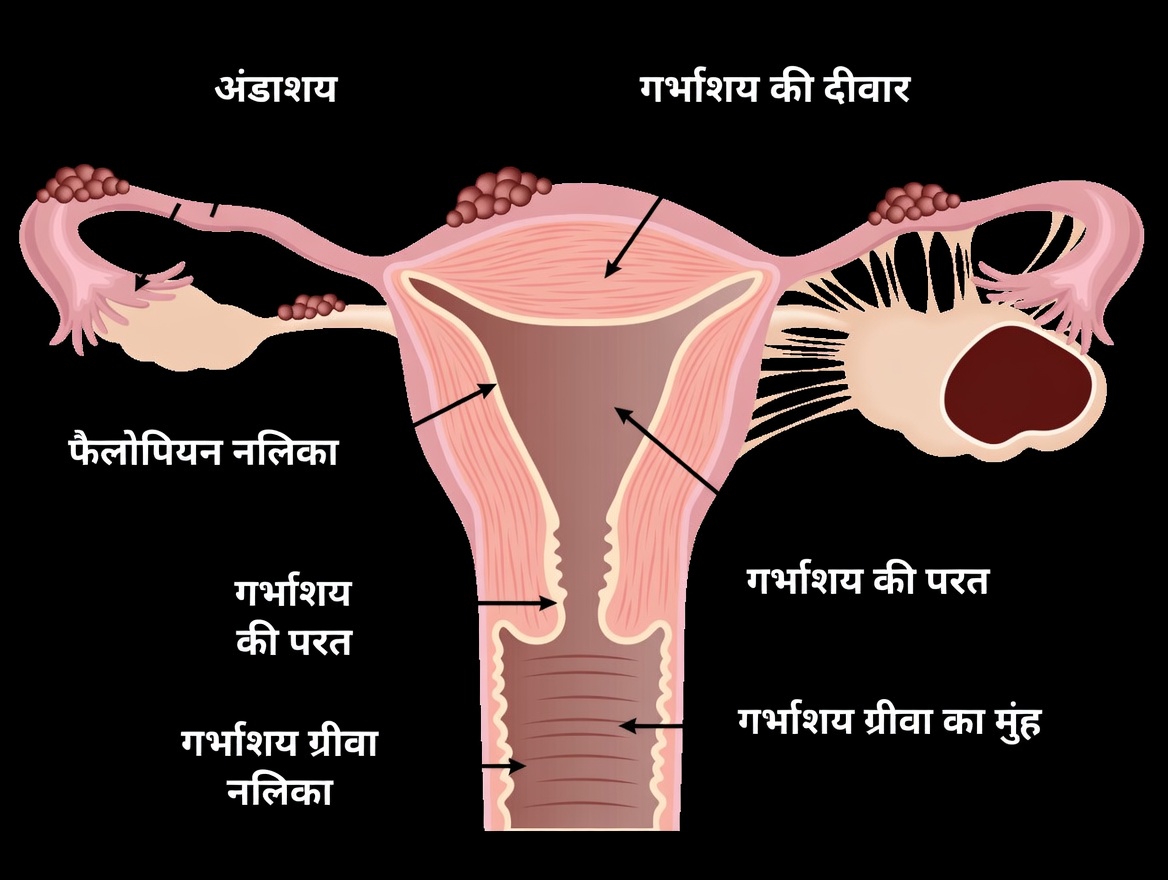 एंडोमेट्रियोसिस चेतावनी: रोज़मर्रा की आदतें जिन्हें आपको नज़रअंदाज़ नहीं करना चाहिए