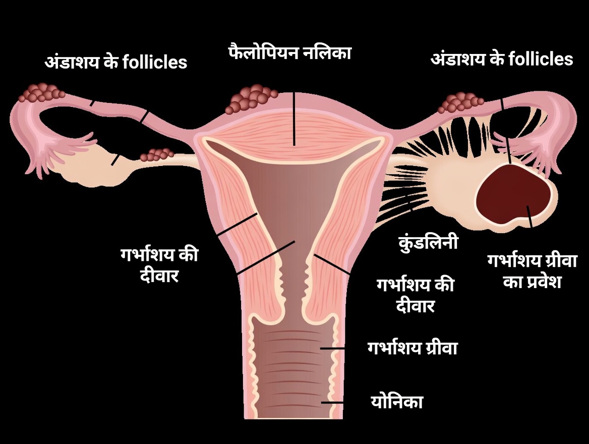 एंडोमेट्रियोसिस चेतावनी: रोजमर्रा की आदतें जिन्हें आपको नज़रअंदाज़ नहीं करना चाहिए