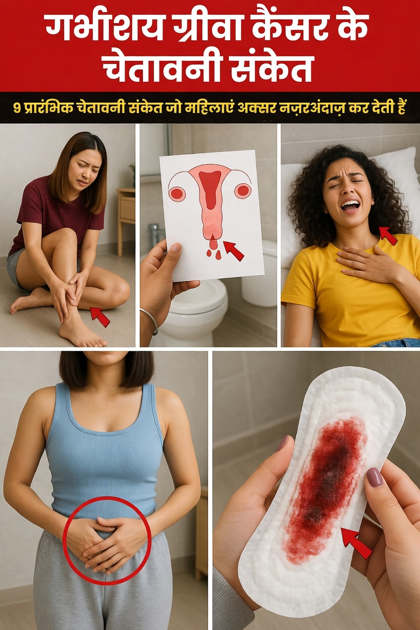 सर्वाइकल कैंसर के 9 शुरुआती चेतावनी संकेत जिन्हें ज़्यादातर महिलाएँ नज़रअंदाज़ कर देती हैं: हर महिला को क्या जानना चाहिए
