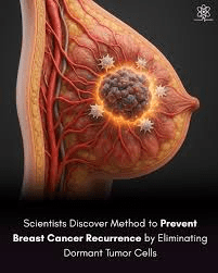 हालिया नैदानिक शोध जीवित बचे रोगियों में सुप्त ट्यूमर कोशिकाओं को लक्षित करने और स्तन कैंसर की पुनरावृत्ति के बारे में क्या उजागर कर रहा है