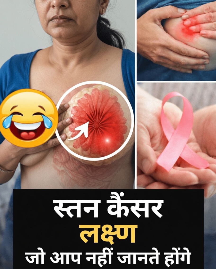 गांठ से परे स्तन कैंसर के लक्षण: कम-ज्ञात संकेत जिन्हें हर महिला को पहचानना चाहिए