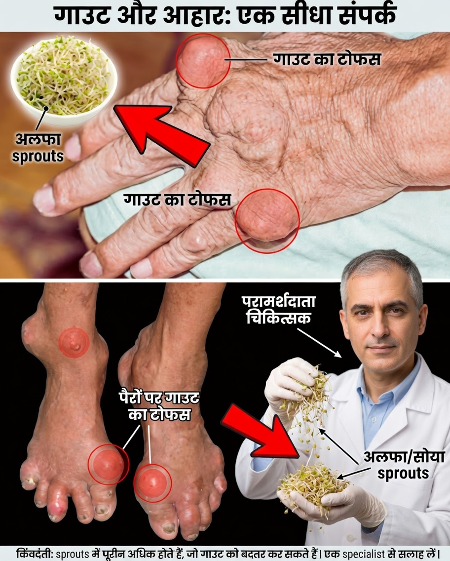 अल्फाल्फा: गुर्दों और जोड़ों के स्वास्थ्य के लिए एक कोमल हरी सहयोगी 🌿🌿