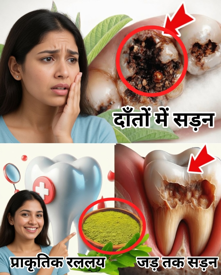अमरूद के पत्तों से दाँतों की सड़न का इलाज करने के शीर्ष 3 तरीके – सरल और किफायती