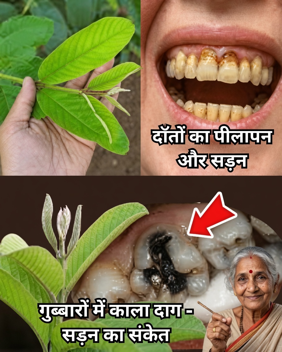 अमरूद के पत्तों से दाँतों की सड़न का इलाज करने के शीर्ष 3 तरीके – सरल और किफायती