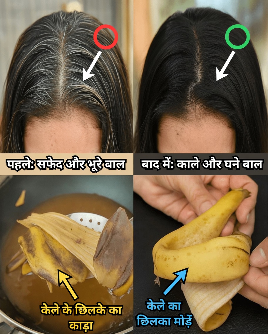 स्वस्थ, मज़बूत बालों के लिए केले के छिलकों की छिपी शक्ति को खोलें