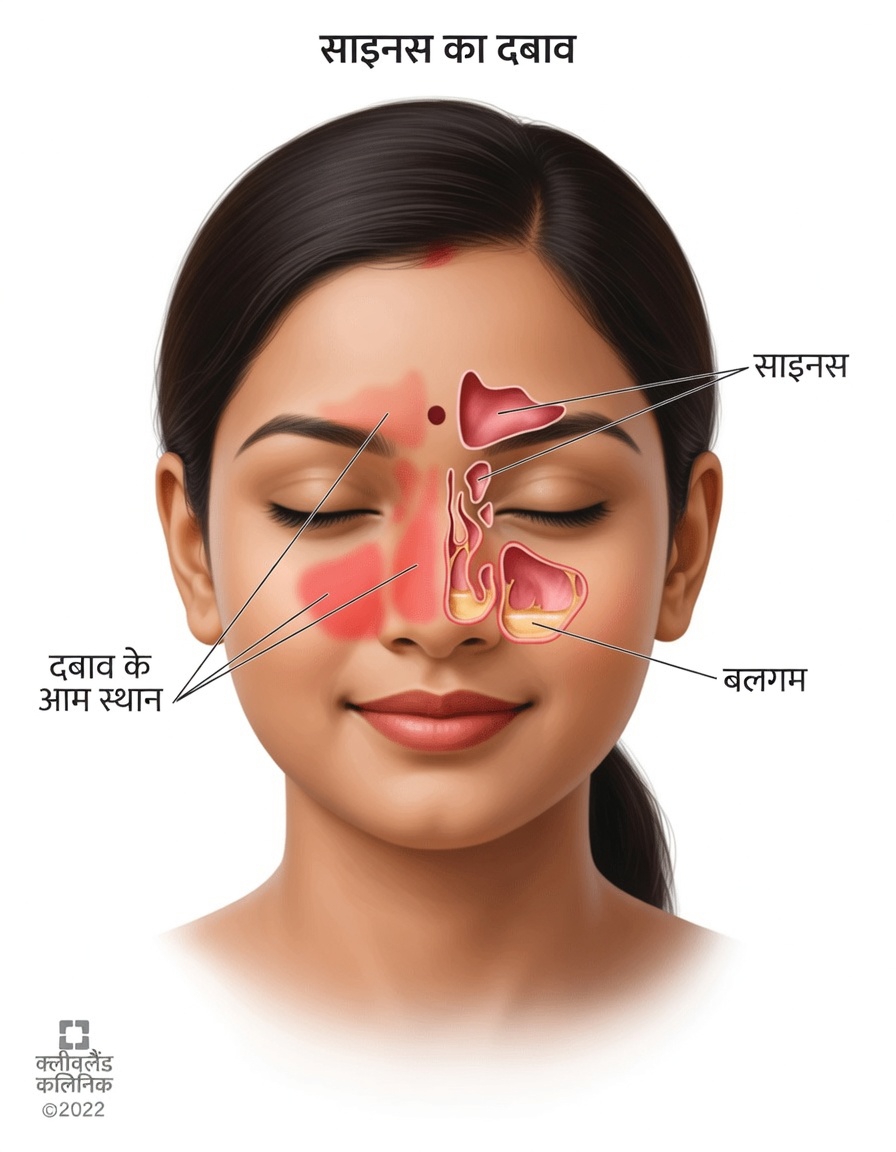 लौंग की भाप लेने की शक्ति: सांस संबंधी राहत जो आपको घंटों नहीं, मिनटों में महसूस हो सकती है