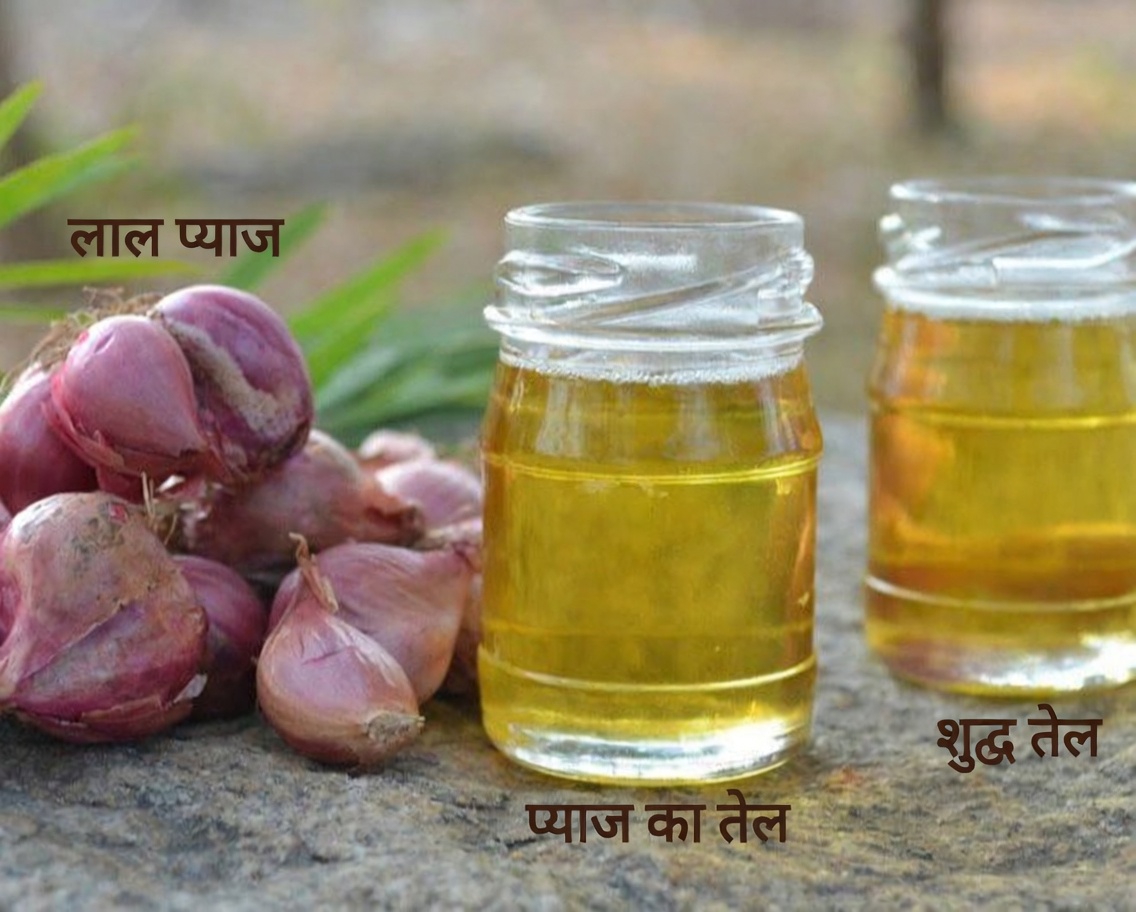 क्यों 1-सप्ताह का प्याज तेल रूटीन प्राकृतिक बालों की देखभाल में ध्यान आकर्षित कर रहा है