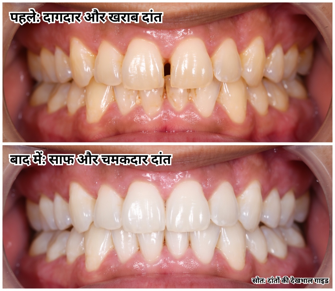 अंडे के छिलके सिर्फ 5 मिनट में पीले दांतों को मोती जैसे सफेद बना देते हैं