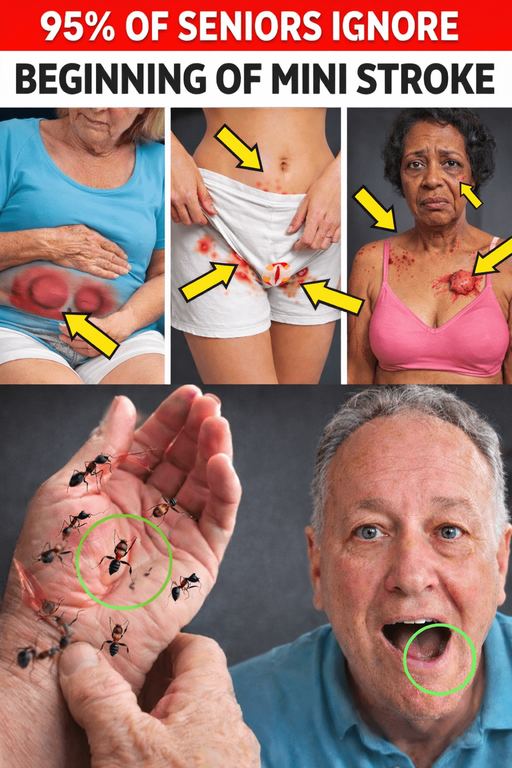 क्षणिक इस्कीमिक अटैक (टीआईए) के 10 सूक्ष्म संकेत जिन्हें 60 वर्ष से अधिक उम्र के लोग अक्सर नजरअंदाज कर देते हैं