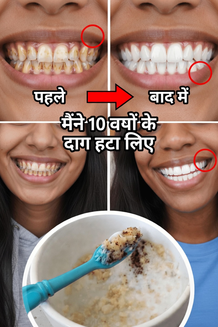 सतही दाग क्यों होते हैं और हल्की पॉलिशिंग क्यों महत्वपूर्ण है