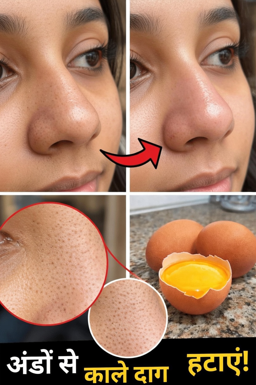 क्या अंडे के सफेद भाग का मास्क बड़े दिखने वाले रोमछिद्रों और ब्लैकहेड्स की दिखावट को कम करने में मदद कर सकता है? घर पर किया जा सकने वाला एक सरल अन्वेषण
