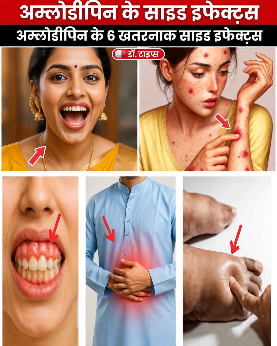 एम्लोडिपिन के सबसे आम दुष्प्रभाव क्या हैं और आप उन्हें कैसे नियंत्रित कर सकते हैं?