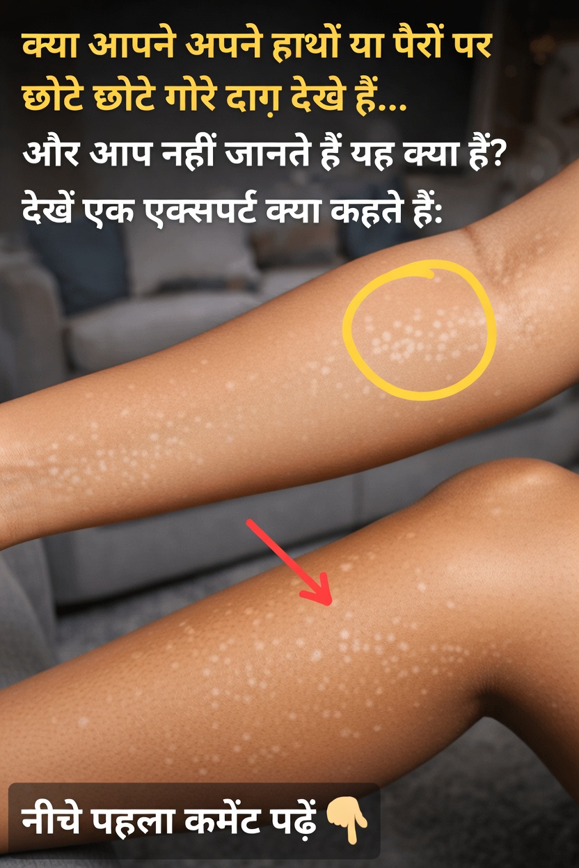 त्वचा पर सफेद धब्बे: कारण, प्रकार और डॉक्टर को कब दिखाएं