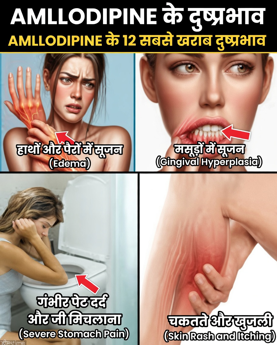 एम्लोडिपिन क्या है और यह दुष्प्रभाव क्यों पैदा करता है?