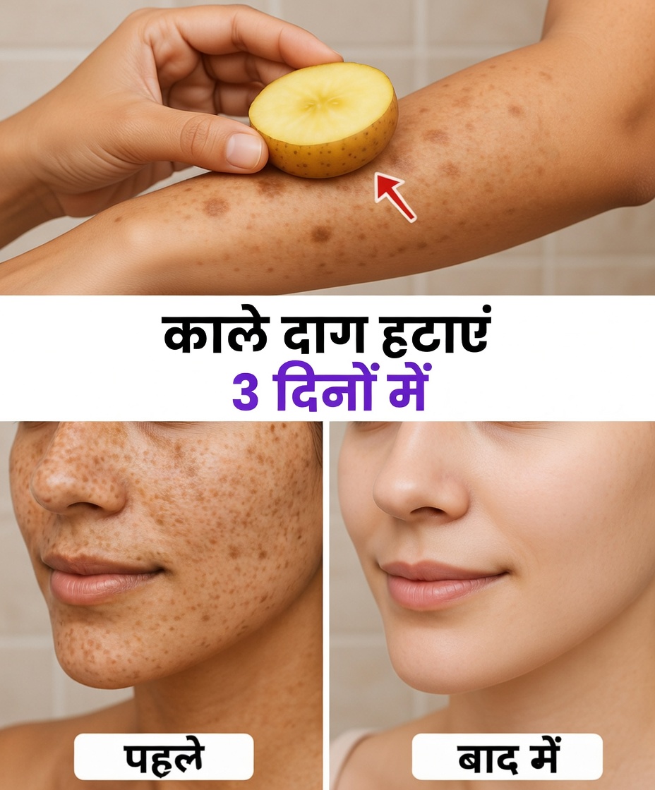 झाइयाँ, मेलाज़्मा, सन स्पॉट, दाग-धब्बे और बुढ़ापे के निशान दूर करें।