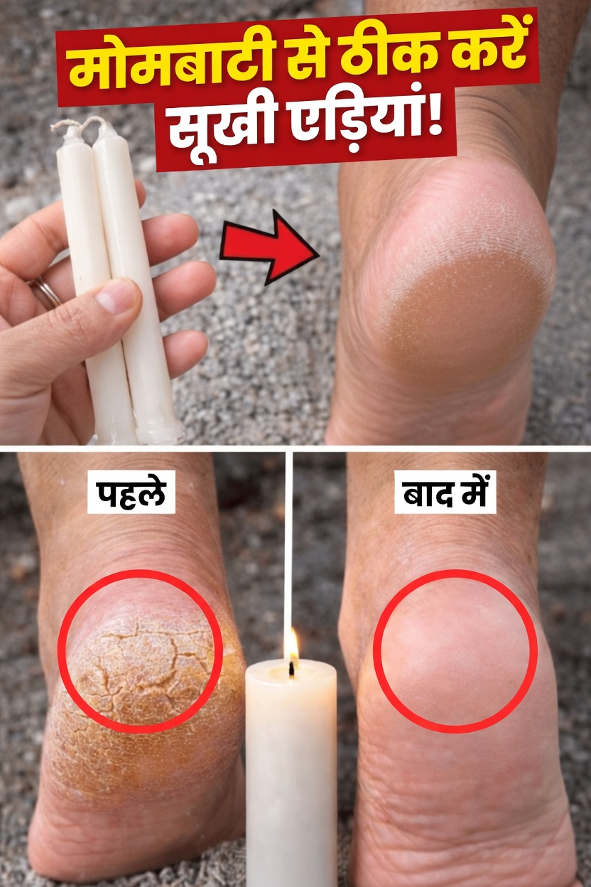 फटी एड़ियों से परेशान हैं? चिकने पैरों के लिए घर पर करें यह आसान वैक्स नरम करने की रूटीन