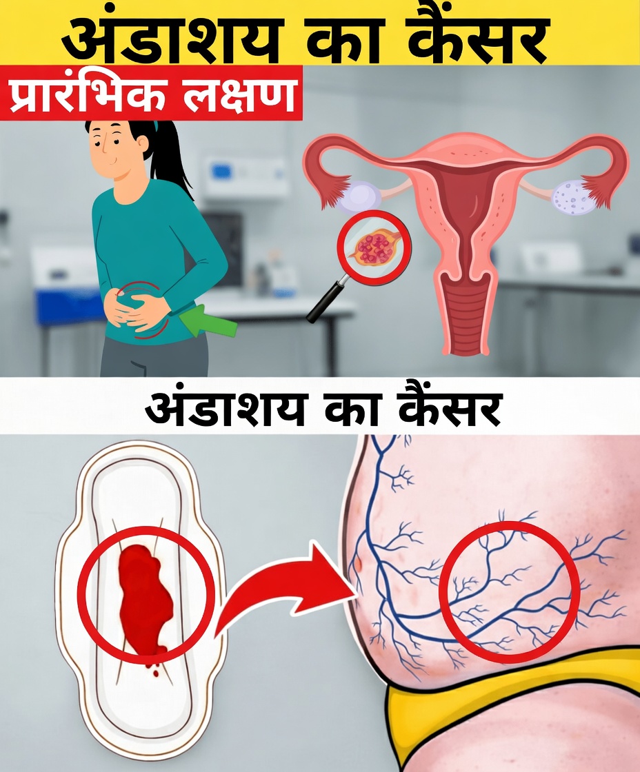 अंडाशय के कैंसर के 8 शुरुआती चेतावनी संकेत, जिनके बारे में हर महिला को पता होना चाहिए