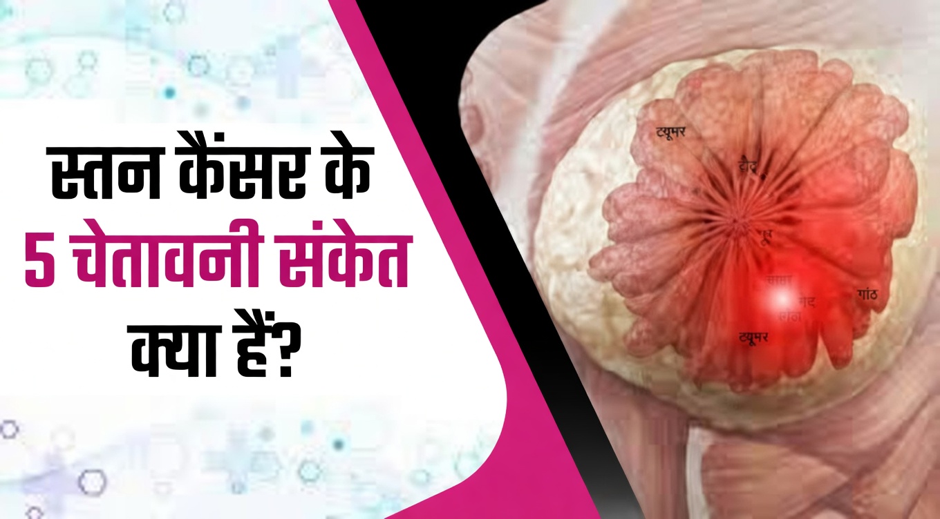 स्तन कैंसर के 4 शुरुआती चेतावनी संकेत, जिनके बारे में हर महिला को पता होना चाहिए