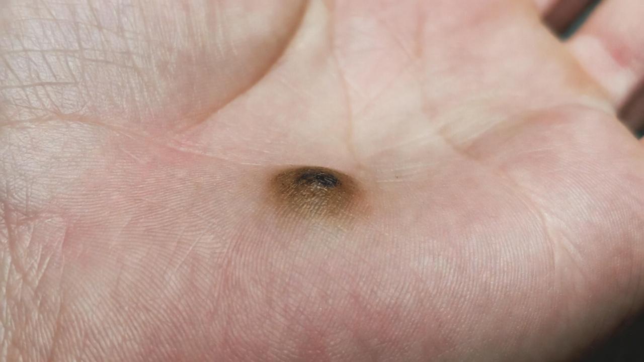 कैंसर के 12 शुरुआती चेतावनी संकेत जिन्हें कभी नज़रअंदाज़ नहीं करना चाहिए