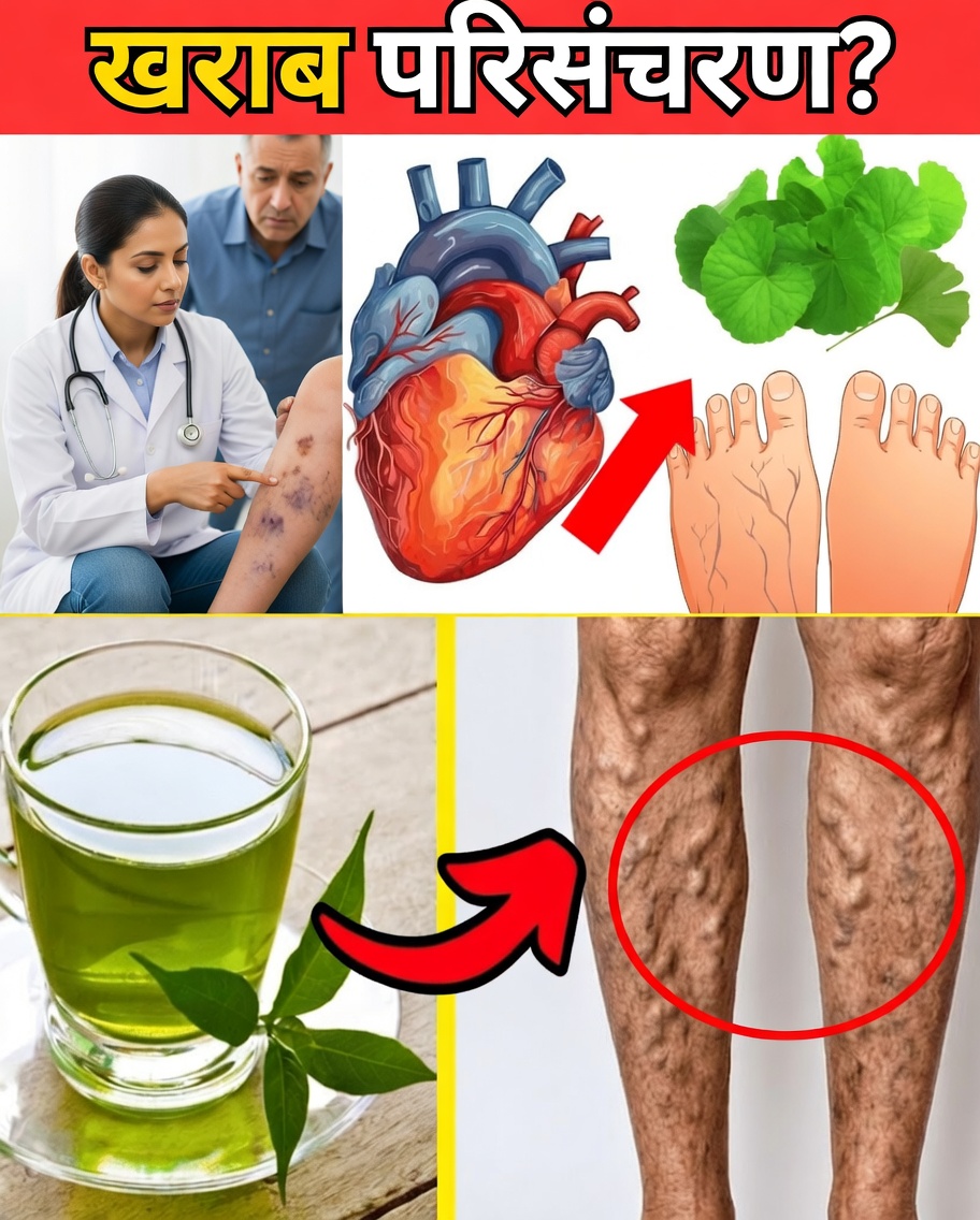 वैरिकाज़ नसों की तकलीफ़ को कम करने और रक्त संचार में सुधार करने के 10 प्राकृतिक तरीके