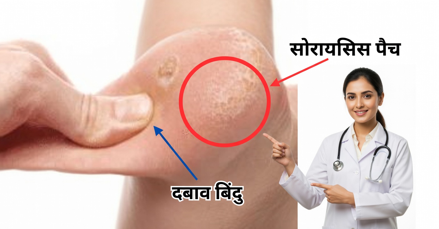 लहसुन से फिश आई हटाएँ