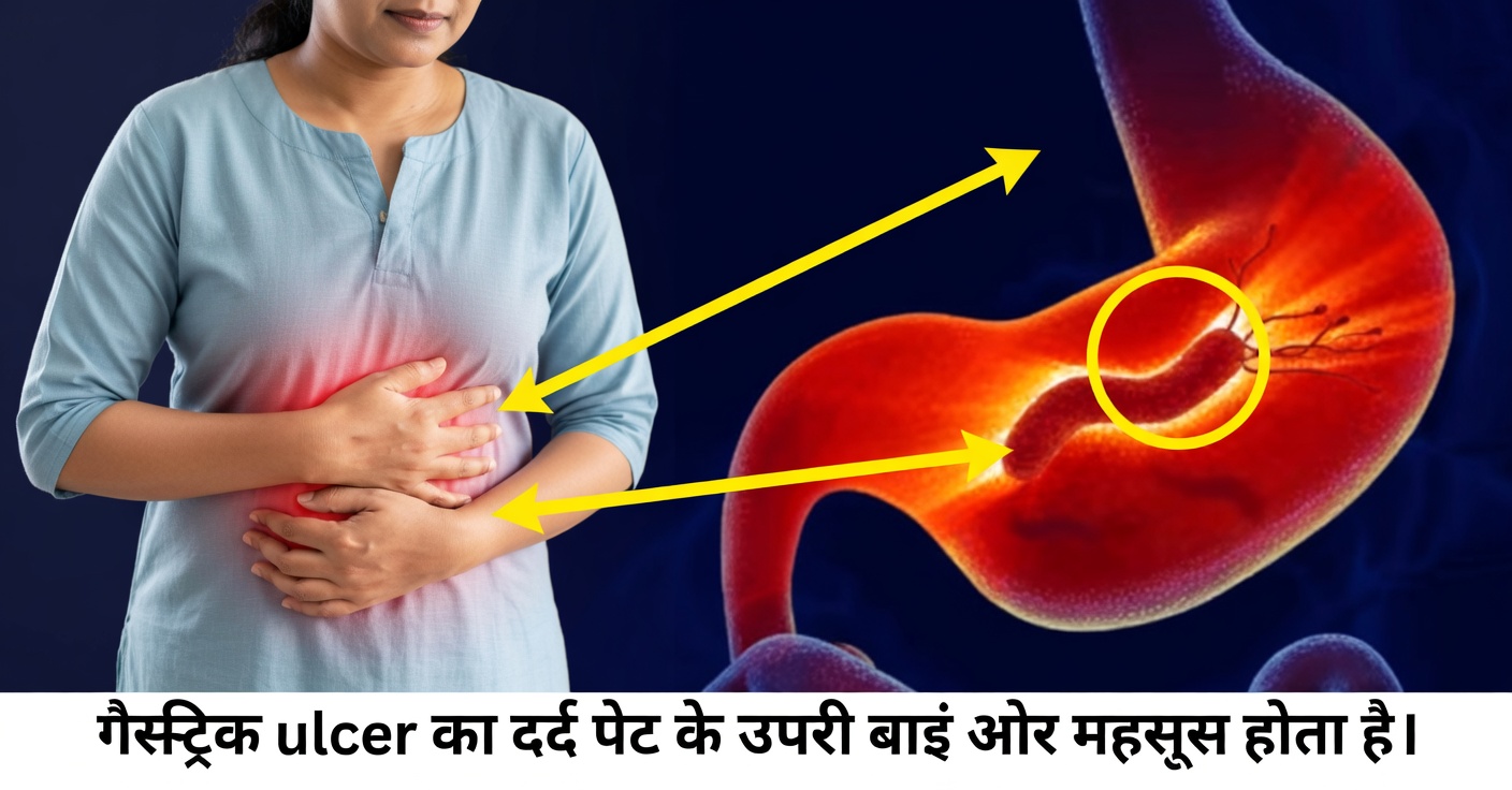 हेलिकोबैक्टर पाइलोरी: लक्षण और 7 प्राकृतिक उपचार