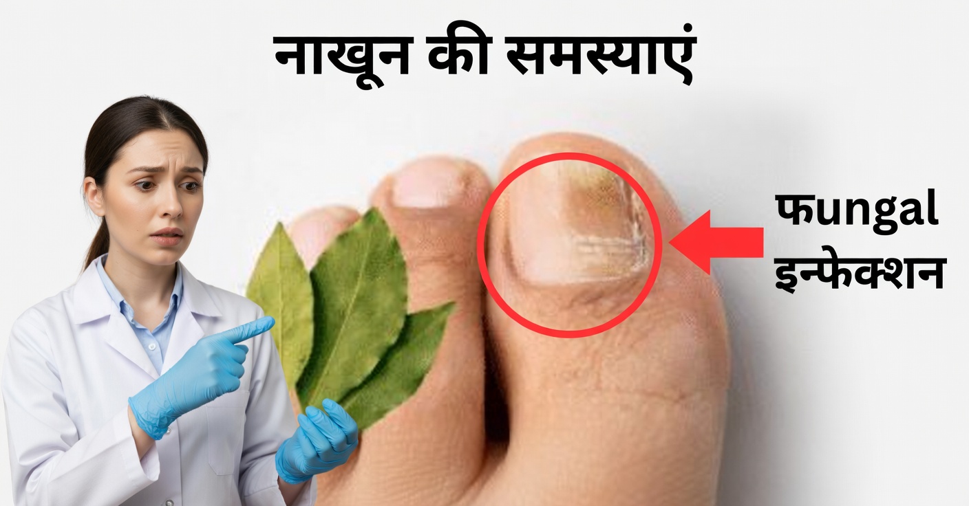 नाखूनों के फंगस के लिए तेज पत्ता: इस प्राकृतिक नुस्खे से उन्हें दूर करें