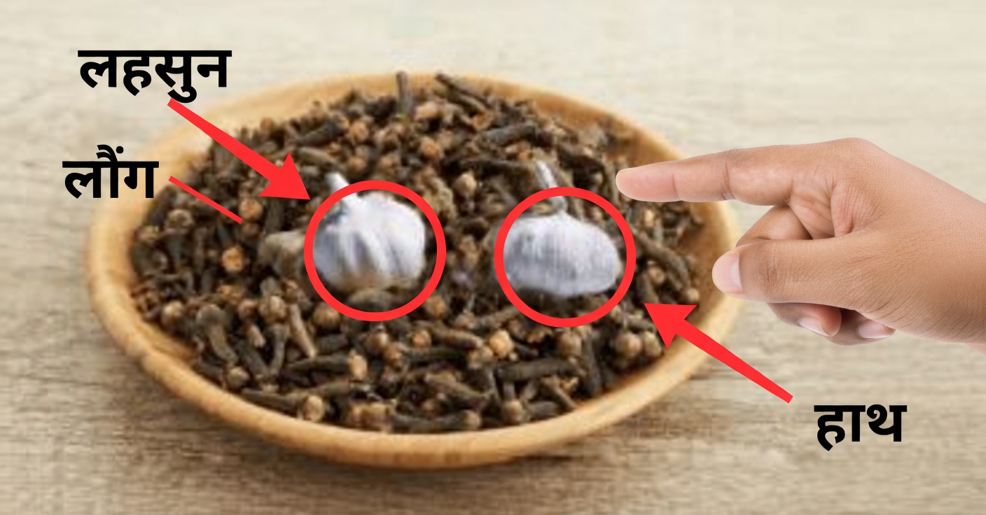 लहसुन, लौंग और अदरक: दर्द और वैरिकाज़ नसों के लिए प्राकृतिक राहत