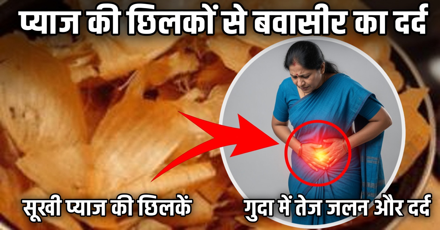 प्याज और छिलके: प्रोस्टेट और मूत्राशय के लिए उपचार