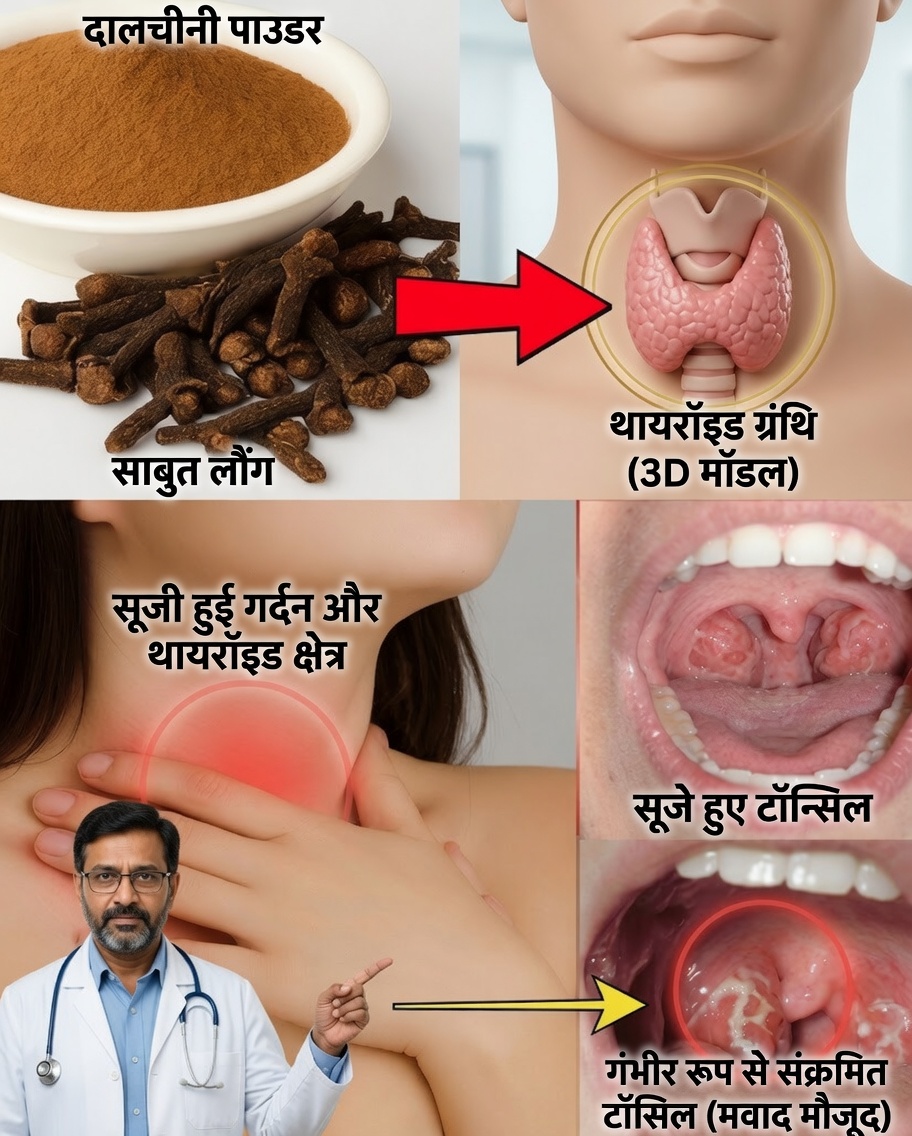 लौंग: छोटा-सा प्राकृतिक उपाय जो गले की खराश को शांत करता है और सूजन से तेज़ी से लड़ता है