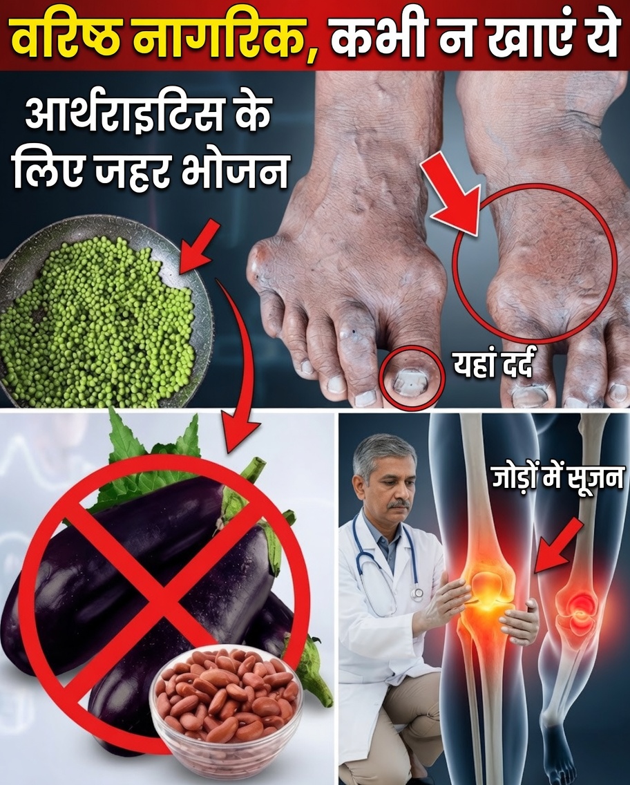 वरिष्ठ सावधान: 10 रोज़मर्रा के खाद्य पदार्थ जो आपके गठिया के दर्द को बढ़ा सकते हैं