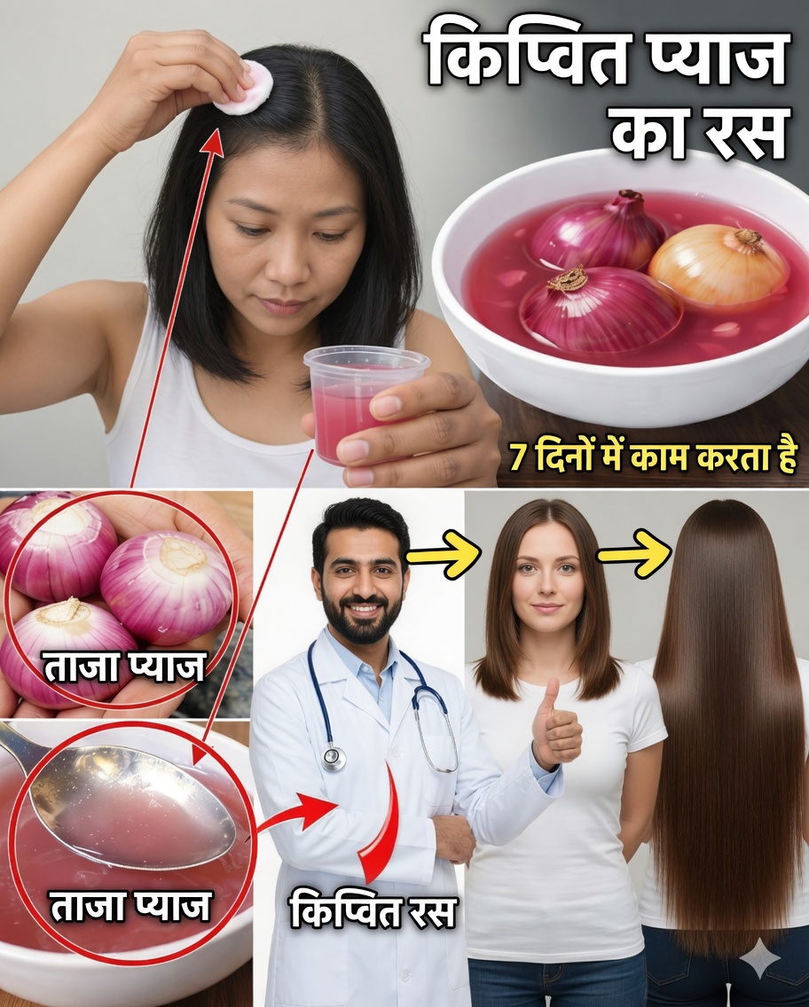 किण्वित प्याज़ का रस: अधिक घने, मजबूत और तेजी से बढ़ने वाले बालों के लिए प्राकृतिक रहस्य