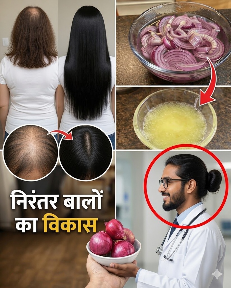 प्याज़ से बालों को और लंबे व घने कैसे करें: वह पुराना नुस्खा जिसे लगभग कोई नहीं जानता