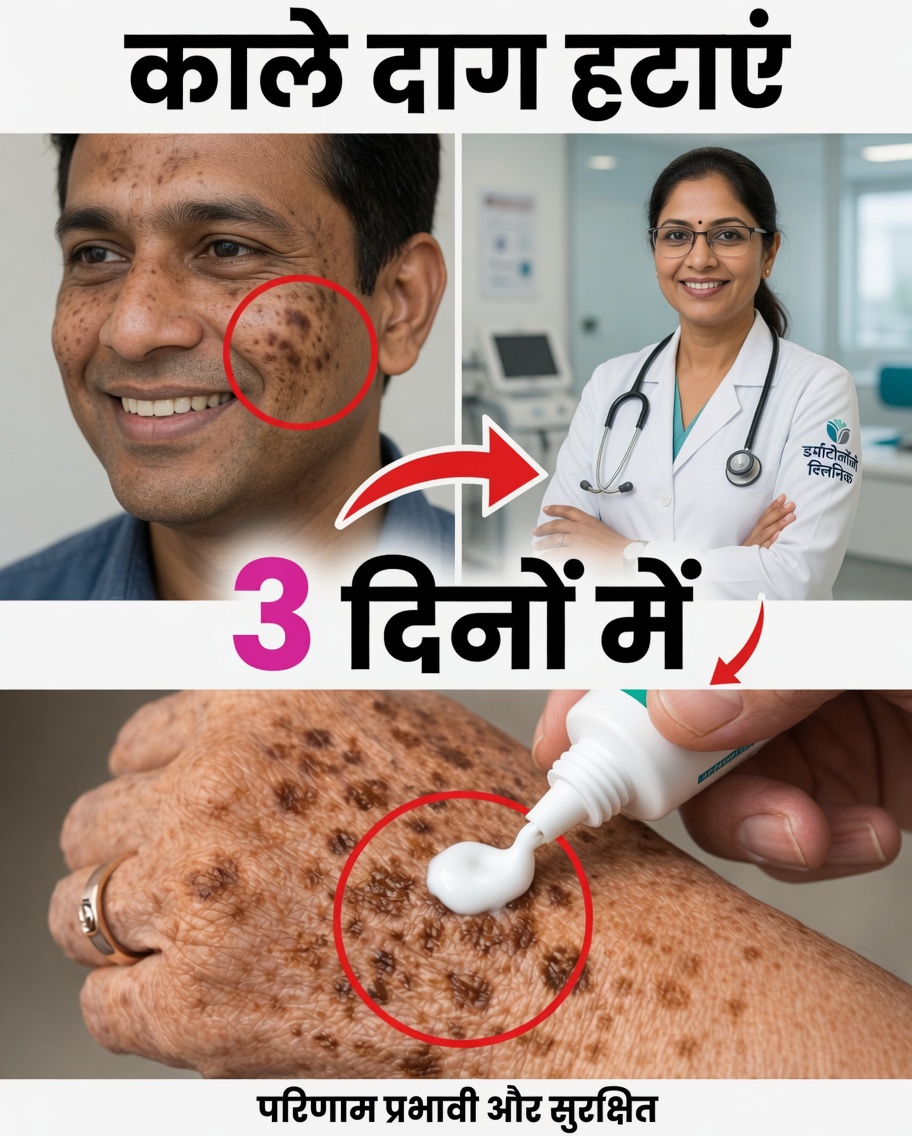 उम्र के दागों को प्राकृतिक रूप से हटाएँ: अधिक उजली और समान त्वचा के लिए कॉर्नस्टार्च, बेकिंग सोडा और नींबू का सरल मास्क