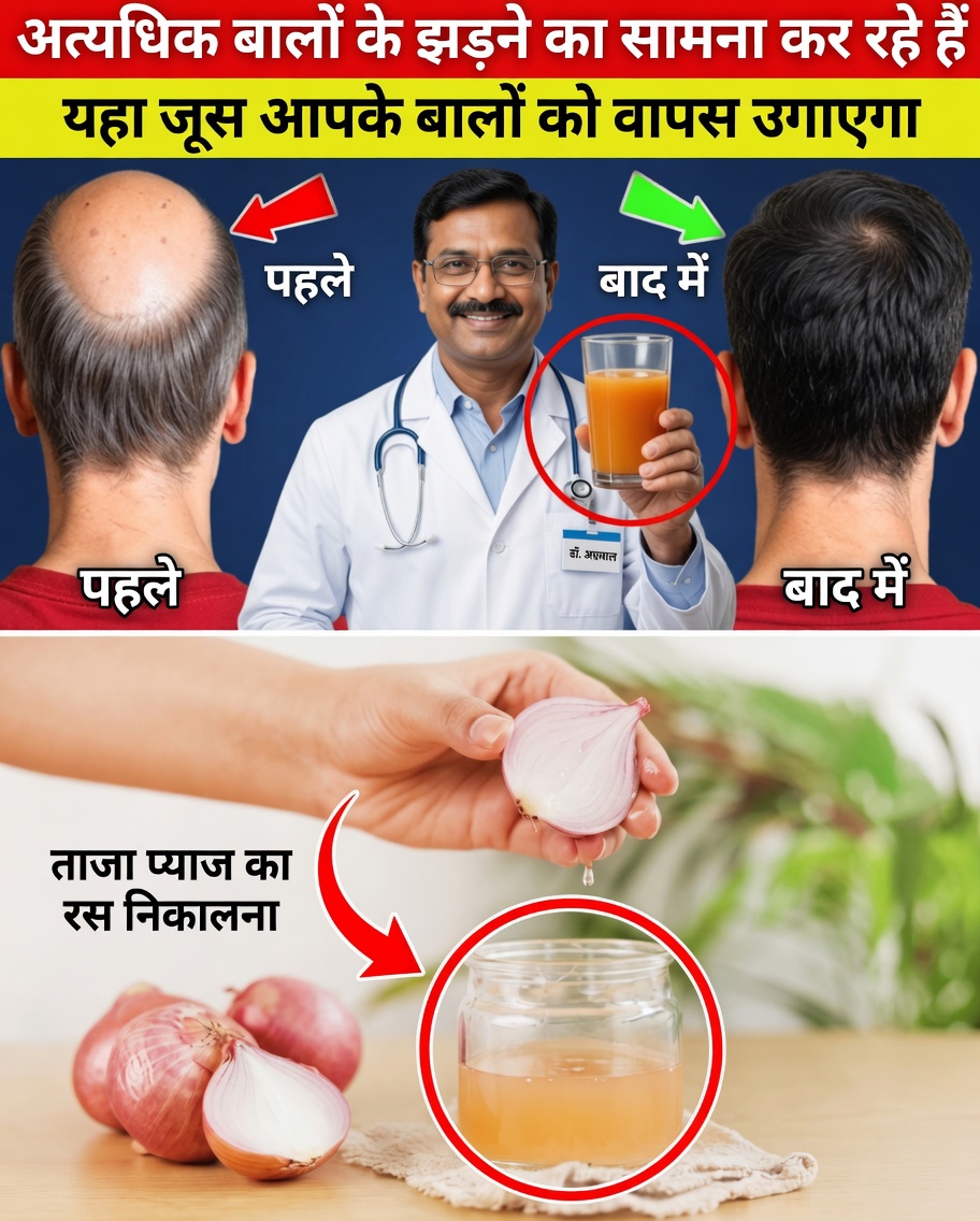 बालों की वृद्धि के लिए प्याज़ का रस: क्या 7 दिन में सचमुच आपकी खोपड़ी का प्राकृतिक रूप से कायाकल्प हो सकता है?