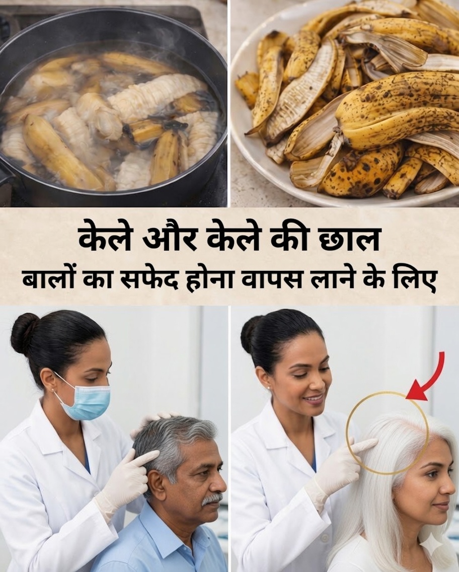 क्या सफेद बाल प्राकृतिक रूप से फिर से काले हो सकते हैं? सफेद बालों को वापस काला करने और बालों की वृद्धि को बढ़ावा देने के लिए केले के छिलके के बारे में सच्चाई