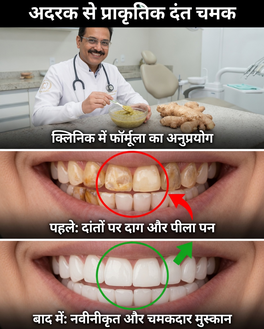 Clareamento dos Dentes com Gengibre: पहले और बाद में – प्रवृत्ति के पीछे वास्तव में क्या है
