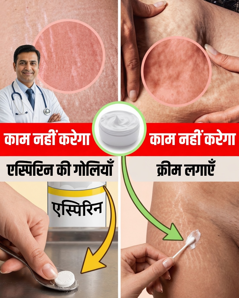 10 शानदार एस्पिरिन हैक्स जो आपको जानने चाहिए: स्वास्थ्य और सौंदर्य के लिए हैरान करने वाले प्राकृतिक उपयोग