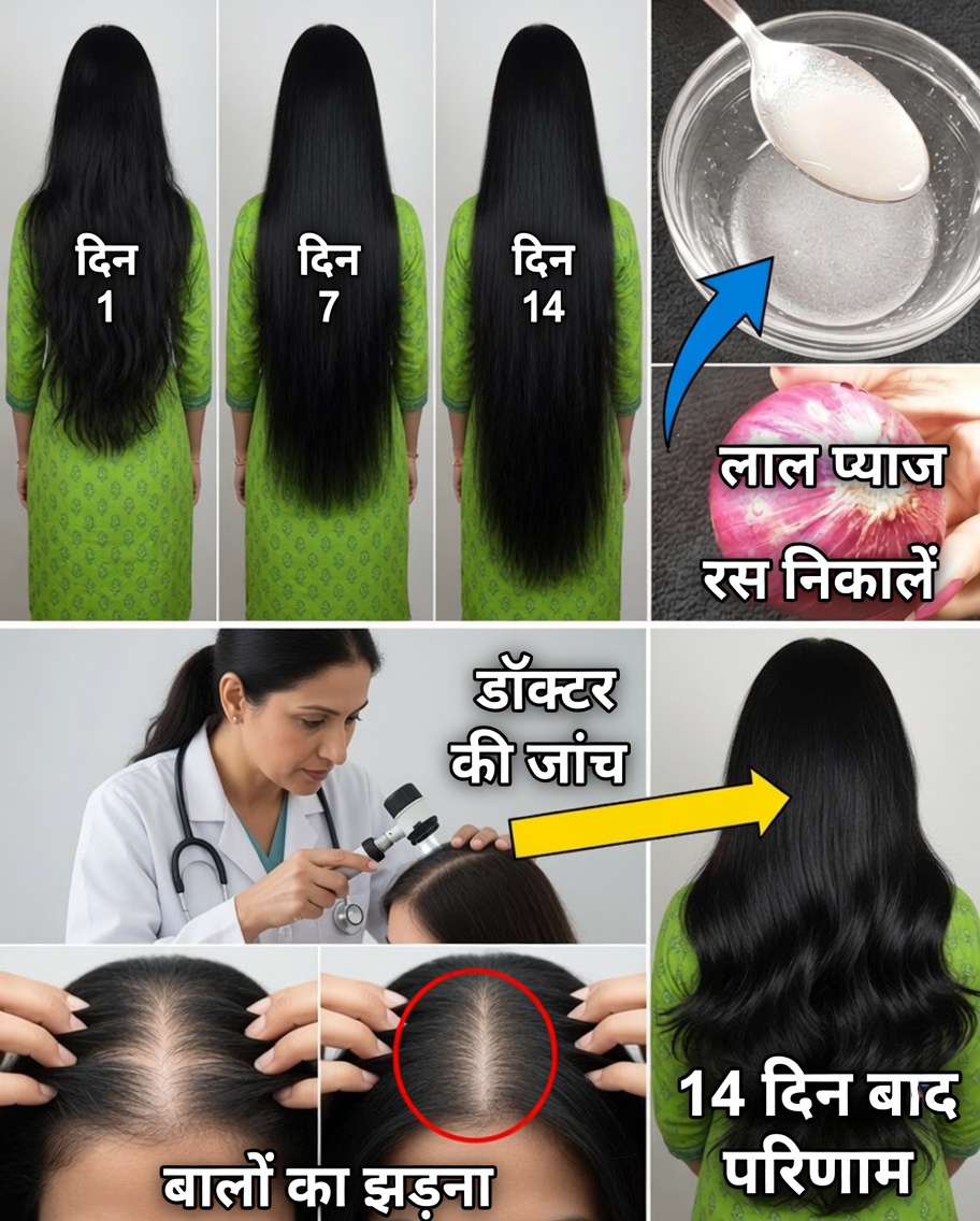 प्याज के रस से प्राकृतिक रूप से बालों की तेज़ बढ़ोतरी पाएं – एक ऐसा राज़ जिसे काश आपने पहले ही जान लिया होता
