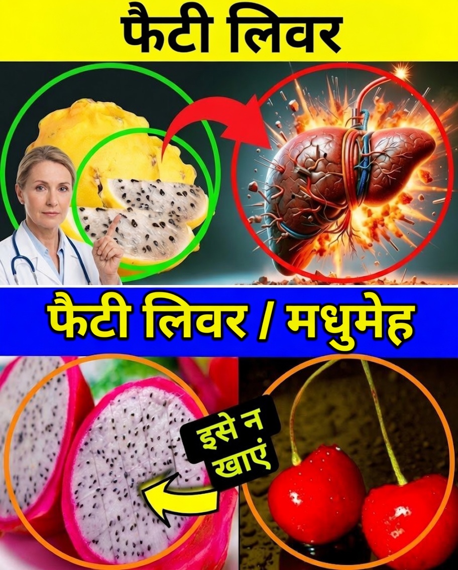 फैटी लिवर को सपोर्ट करने वाला #1 फल (साथ ही 9 प्राकृतिक खाद्य पदार्थ जो ठीक होने में मदद करते हैं!)
