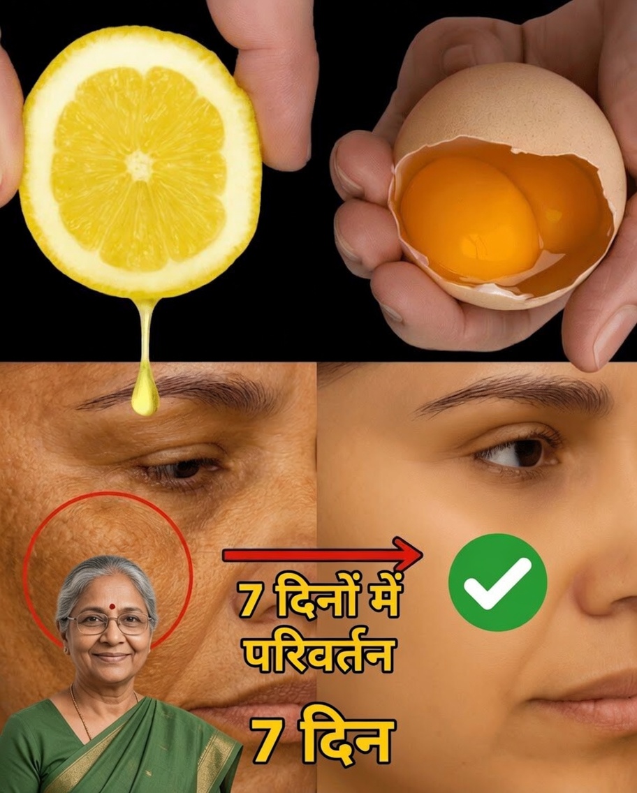 नींबू और अंडे का मिश्रण: प्राकृतिक रूप से युवा त्वचा के लिए