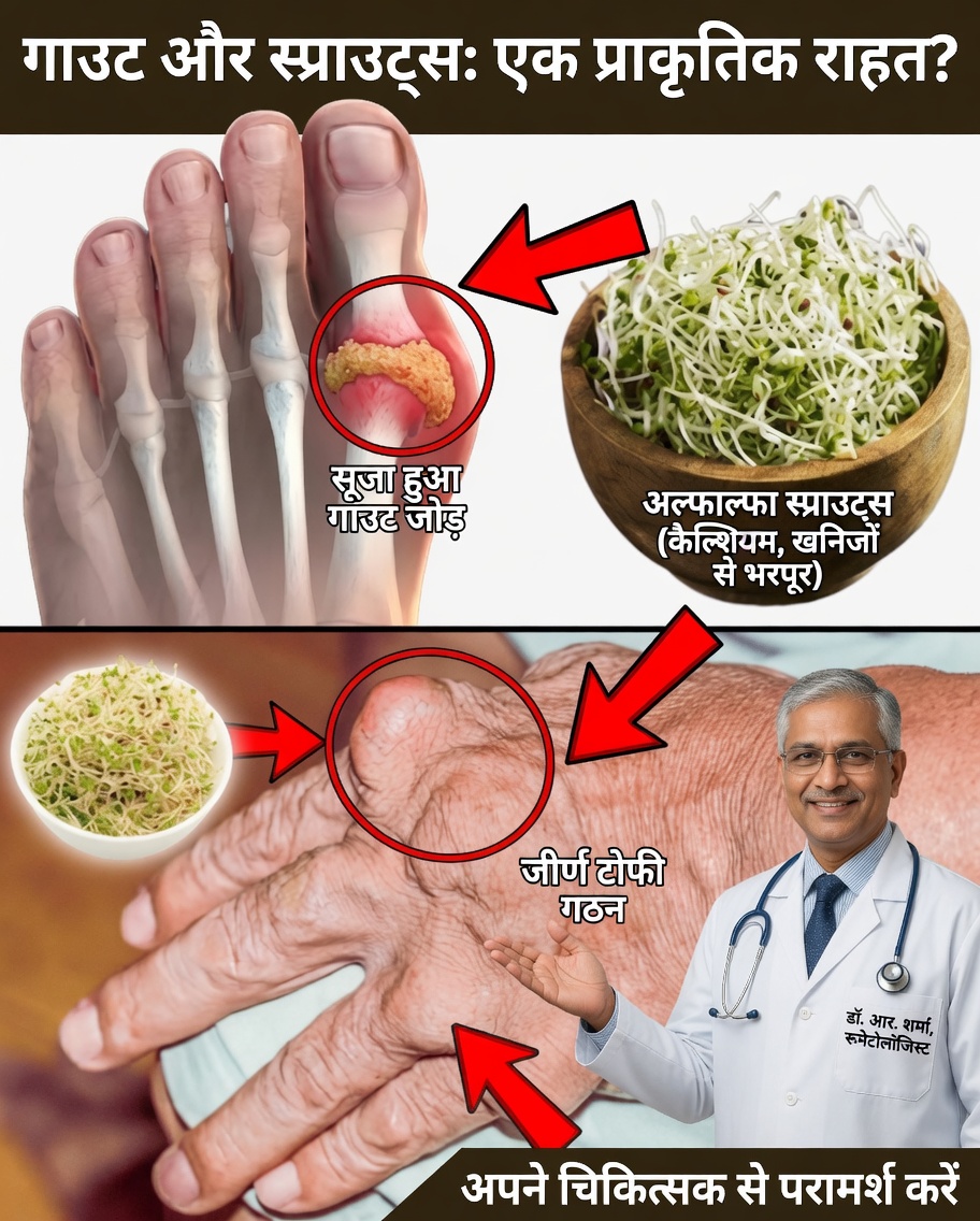 अल्फाल्फा की छिपी शक्ति को उजागर करें: किडनी स्टोन और गाउट से राहत का एक प्राकृतिक मार्ग