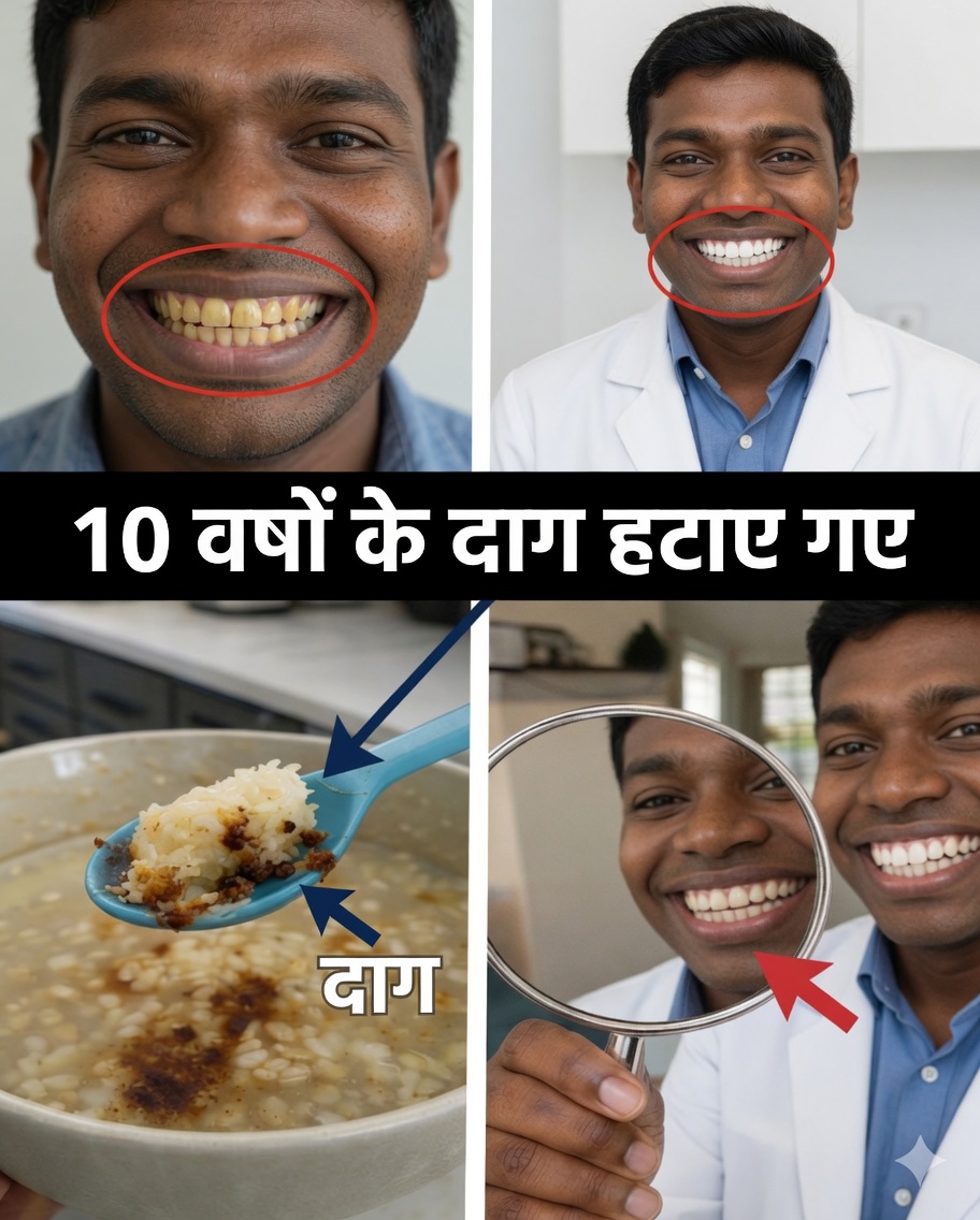 2 मिनट में दाँतों के 10 साल पुराने दाग हटाएँ? वह सच्चाई जो आपको हैरान कर देगी