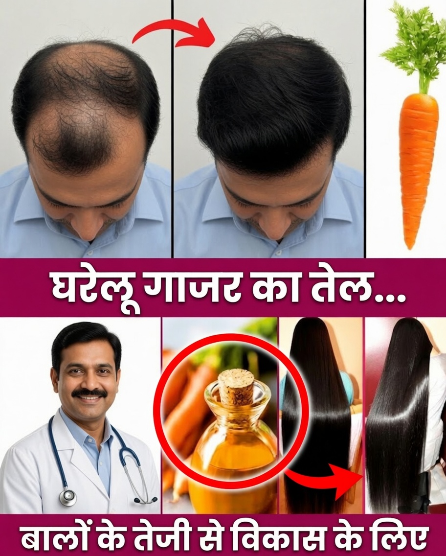 बालों को तेज़ी से कैसे बढ़ाएं, झड़ना कैसे रोकें और प्राकृतिक तरीके से गंजापन कैसे कम करें