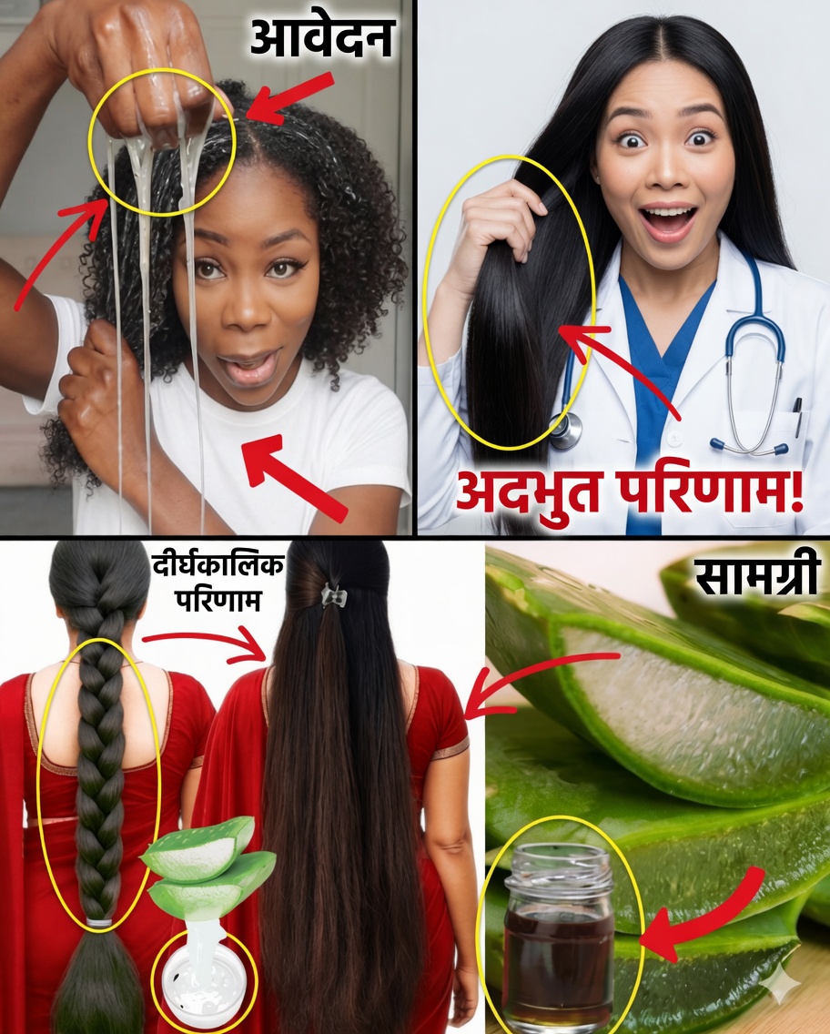 तेज़ बालों की वृद्धि, घने बालों और स्वस्थ स्कैल्प के लिए घर पर बना एलोवेरा और लौंग जेल
